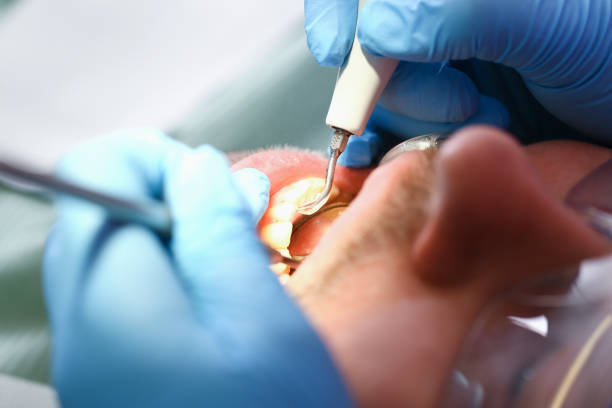 Best Emergency Treatment for Toothache in Exmore, VA